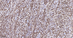 FUT4 Antibody in Immunohistochemistry (Paraffin) (IHC (P))