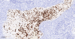 FUT4 Antibody in Immunohistochemistry (Paraffin) (IHC (P))