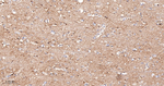 FUT4 Antibody in Immunohistochemistry (Paraffin) (IHC (P))