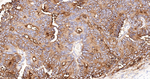 FUT4 Antibody in Immunohistochemistry (Paraffin) (IHC (P))