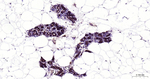 NFkB p65 Antibody in Immunohistochemistry (Paraffin) (IHC (P))