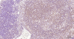 NFkB p65 Antibody in Immunohistochemistry (Paraffin) (IHC (P))