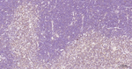 NFkB p65 Antibody in Immunohistochemistry (Paraffin) (IHC (P))