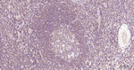 NFkB p65 Antibody in Immunohistochemistry (Paraffin) (IHC (P))