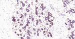 NFkB p65 Antibody in Immunohistochemistry (Paraffin) (IHC (P))