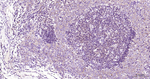 NFkB p65 Antibody in Immunohistochemistry (Paraffin) (IHC (P))