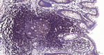 NFkB p65 Antibody in Immunohistochemistry (Paraffin) (IHC (P))