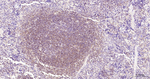 NFkB p65 Antibody in Immunohistochemistry (Paraffin) (IHC (P))