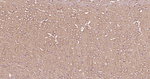 beta Tubulin Antibody in Immunohistochemistry (Paraffin) (IHC (P))
