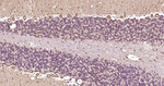 beta Tubulin Antibody in Immunohistochemistry (Paraffin) (IHC (P))