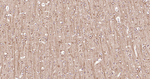 beta Tubulin Antibody in Immunohistochemistry (Paraffin) (IHC (P))