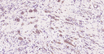beta Tubulin Antibody in Immunohistochemistry (Paraffin) (IHC (P))