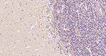 beta Tubulin Antibody in Immunohistochemistry (Paraffin) (IHC (P))