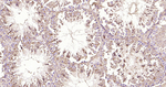 beta Tubulin Antibody in Immunohistochemistry (Paraffin) (IHC (P))