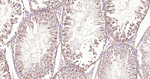 beta Tubulin Antibody in Immunohistochemistry (Paraffin) (IHC (P))