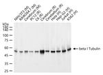 TUBB1 Recombinant Rabbit Monoclonal Antibody (1G1)
