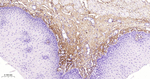 Collagen III Antibody in Immunohistochemistry (Paraffin) (IHC (P))