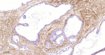 Collagen III Antibody in Immunohistochemistry (Paraffin) (IHC (P))