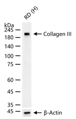 Collagen III Antibody in Western Blot (WB)