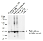 ACTA1 Monoclonal Antibody (6C12)