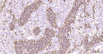 Vimentin Antibody in Immunohistochemistry (Paraffin) (IHC (P))