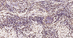 Vimentin Antibody in Immunohistochemistry (Paraffin) (IHC (P))