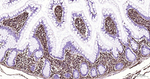 Vimentin Antibody in Immunohistochemistry (Paraffin) (IHC (P))