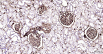 Vimentin Antibody in Immunohistochemistry (Paraffin) (IHC (P))