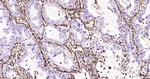 Vimentin Antibody in Immunohistochemistry (Paraffin) (IHC (P))