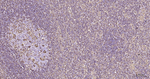 Vimentin Antibody in Immunohistochemistry (Paraffin) (IHC (P))