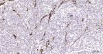 Vimentin Recombinant Rabbit Monoclonal Antibody (6A2)