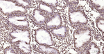 Vimentin Antibody in Immunohistochemistry (Paraffin) (IHC (P))