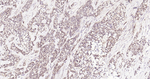 HSC70 Monoclonal Antibody (8C7)