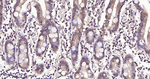 HSC70 Antibody in Immunohistochemistry (Paraffin) (IHC (P))