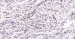 HSC70 Antibody in Immunohistochemistry (Paraffin) (IHC (P))