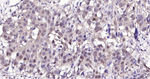 HSC70 Antibody in Immunohistochemistry (Paraffin) (IHC (P))