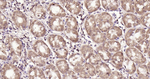 HSC70 Antibody in Immunohistochemistry (Paraffin) (IHC (P))