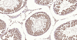 HSC70 Antibody in Immunohistochemistry (Paraffin) (IHC (P))