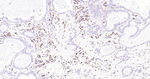 Cyclophilin B Antibody in Immunohistochemistry (Paraffin) (IHC (P))