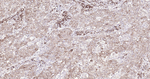 Cyclophilin B Antibody in Immunohistochemistry (Paraffin) (IHC (P))