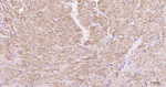 Desmin Antibody in Immunohistochemistry (Paraffin) (IHC (P))