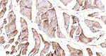 Desmin Antibody in Immunohistochemistry (Paraffin) (IHC (P))