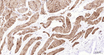 Desmin Antibody in Immunohistochemistry (Paraffin) (IHC (P))