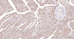 Desmin Antibody in Immunohistochemistry (Paraffin) (IHC (P))
