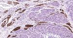 Desmin Antibody in Immunohistochemistry (Paraffin) (IHC (P))