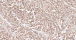 Desmin Antibody in Immunohistochemistry (Paraffin) (IHC (P))