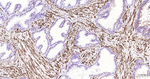 Desmin Antibody in Immunohistochemistry (Paraffin) (IHC (P))