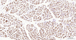 Desmin Antibody in Immunohistochemistry (Paraffin) (IHC (P))