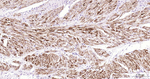 Desmin Antibody in Immunohistochemistry (Paraffin) (IHC (P))