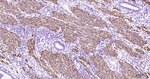 Desmin Antibody in Immunohistochemistry (Paraffin) (IHC (P))